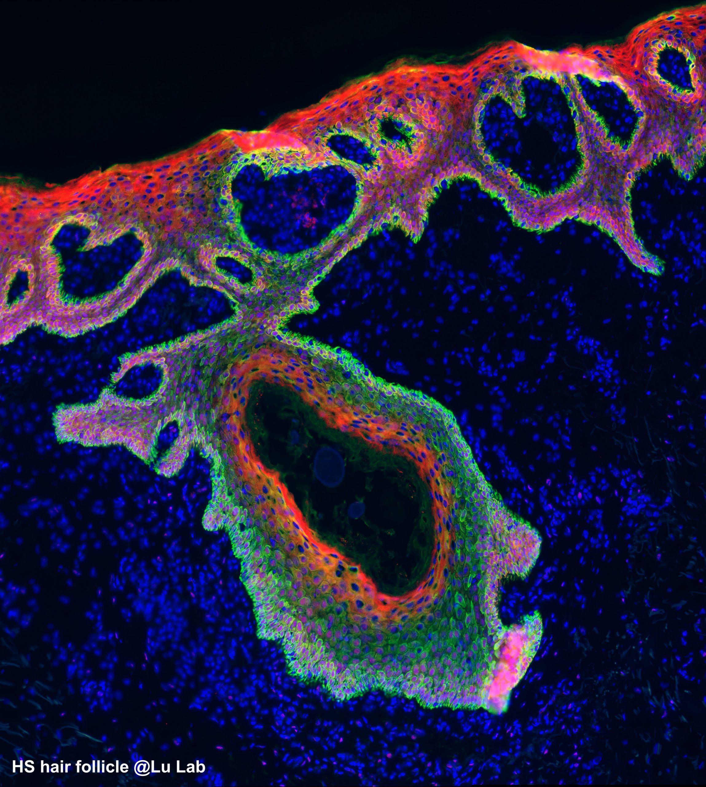 HS hair follicle@Lu Lab Labeled