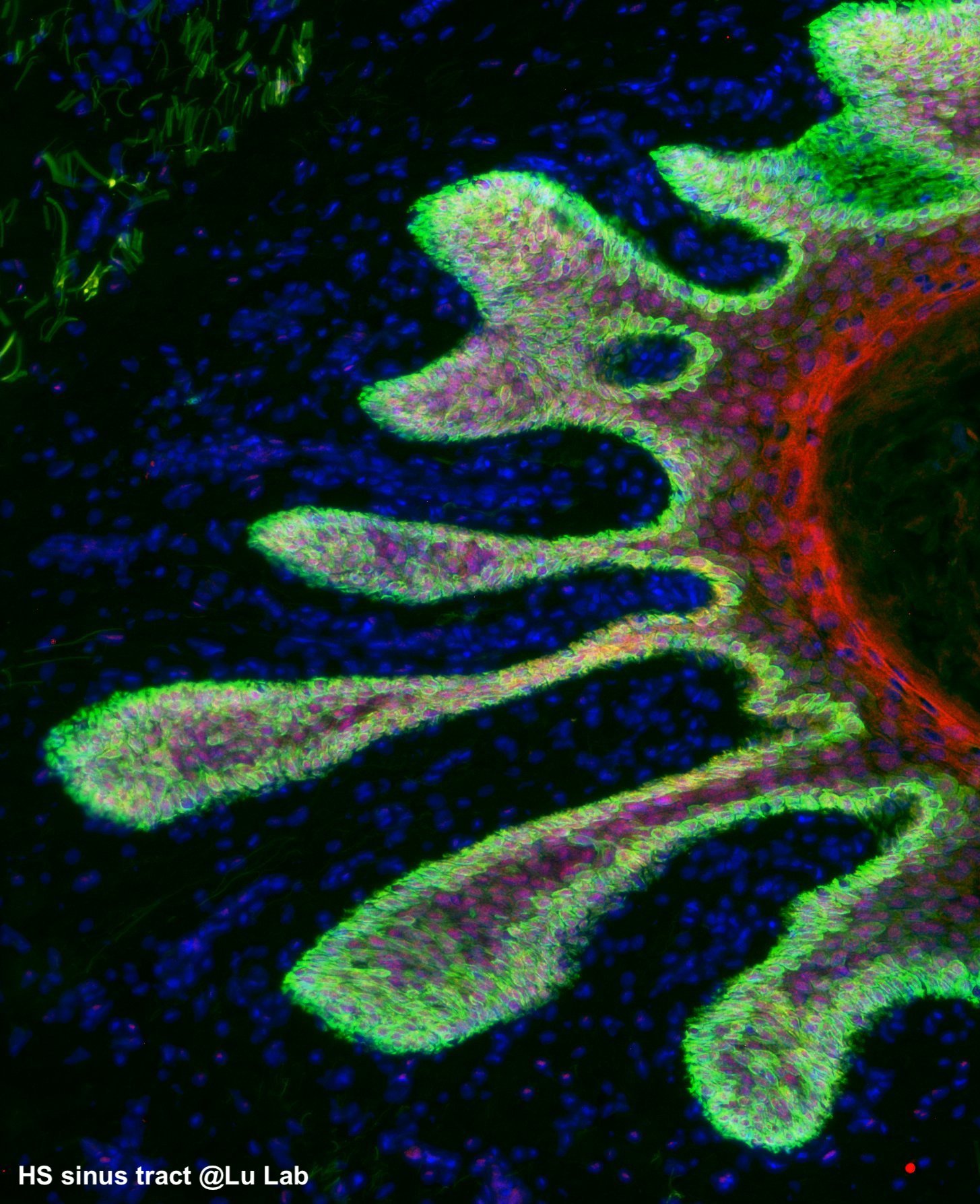 HS sinus tract@Lu Lab Labeled